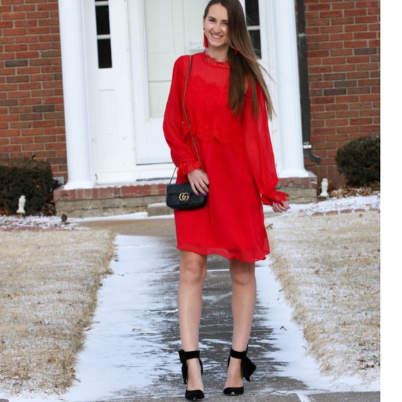 Xhileration | Lacy Dress - Picture 3 of 13